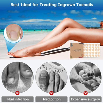Comfort Care Ingrown Toenail Corrector™