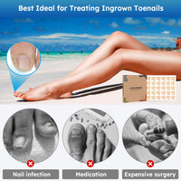Comfort Care Ingrown Toenail Corrector™